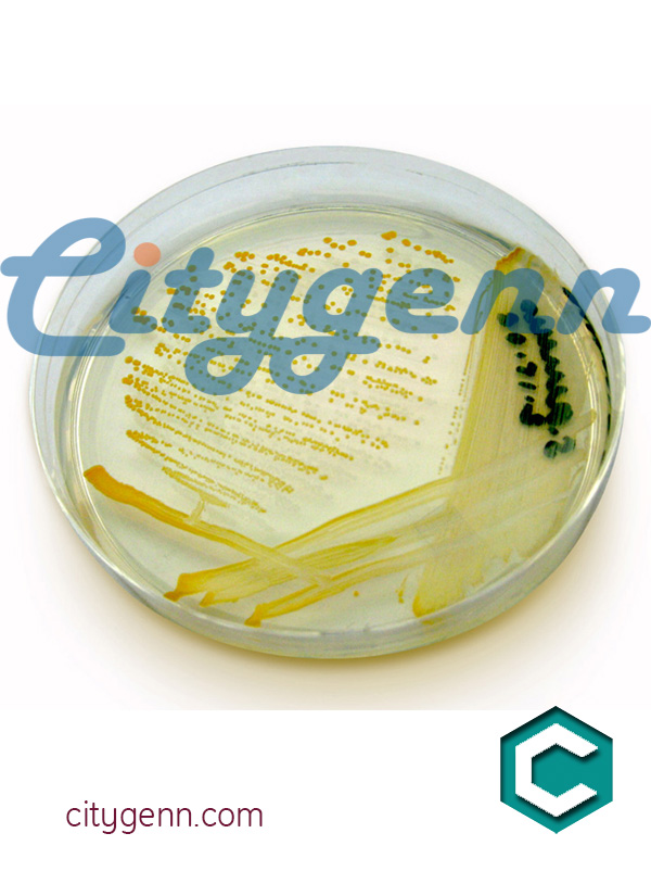 Nutrient agar Nutrient agar