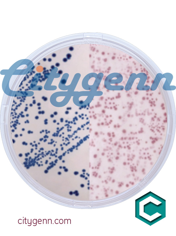 Lysine Lysine